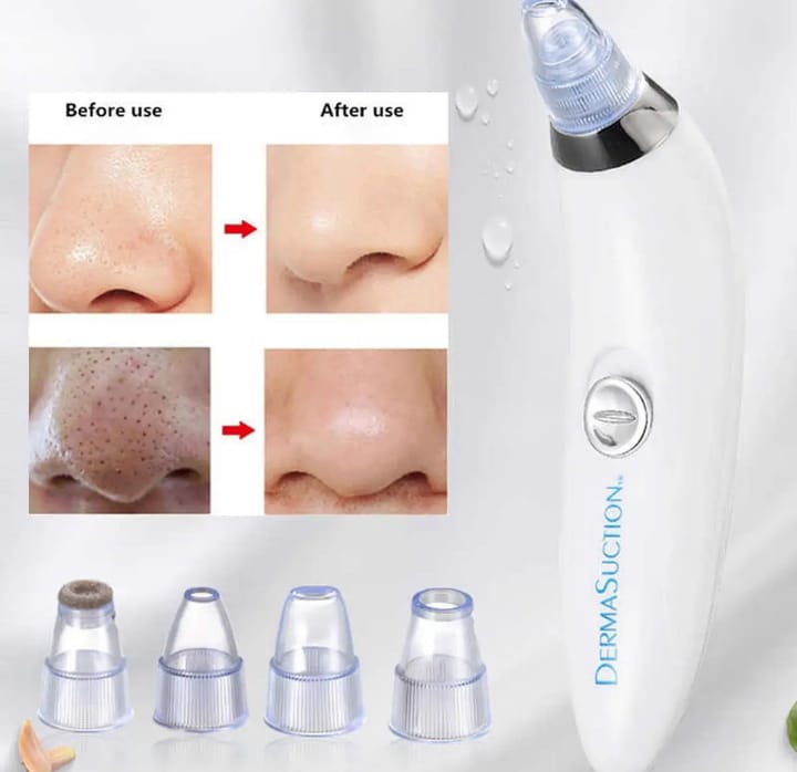 4-in-1 Derma Suction Blackhead Removal Machine – Acne & Pore Cleaner